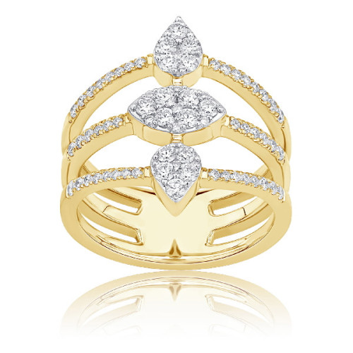 Ava ring